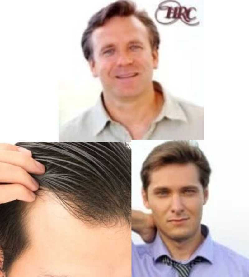 premium-edge-light-hairpieces-for-a-natural-appearance-big-0