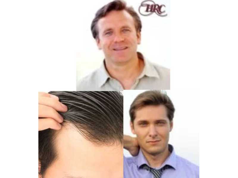premium-edge-light-hairpieces-for-a-natural-appearance-small-0