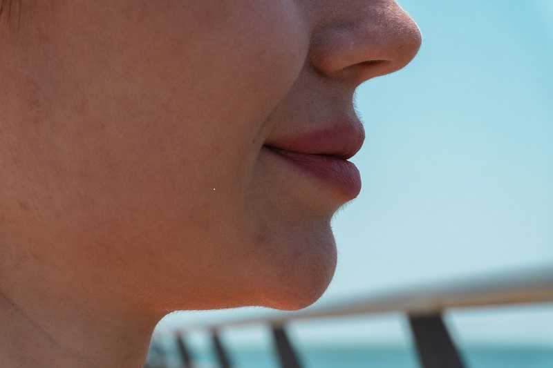 double-chin-reduction-san-mateo-non-surgical-contouring-big-0