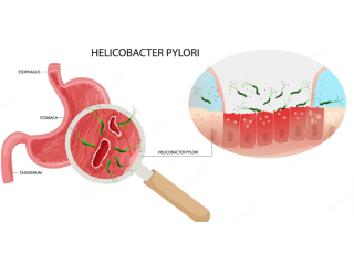 Effective Helicobacter Pylori Treatment