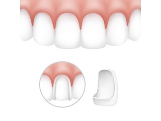 The Lifespan of Front Tooth Crowns: What You Need to Know