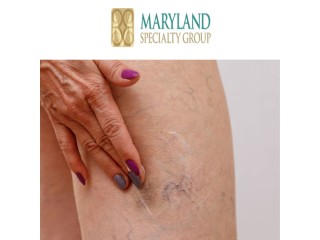 Revitalize Your Legs: Laser Vein Treatments by Maryland's Speciality Group