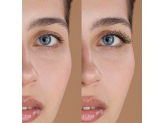 Eyelid Rejuvenation: Expert Cosmetic Surgery in Coral Gables