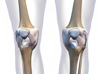 Knee Pain Doctor In New York