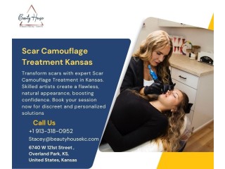 Cover Up Scars: Scar Camouflage Treatment in Kansas