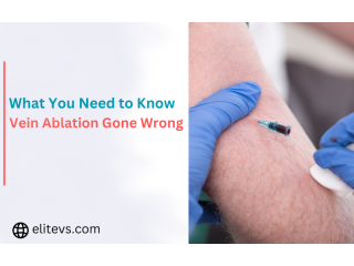 Who Is Responsible for Vein Ablation Gone Wrong?