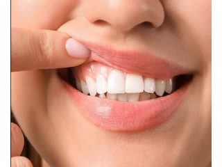 Smile Brighter with Dentist Sacramento California | Dr. Monica Crooks