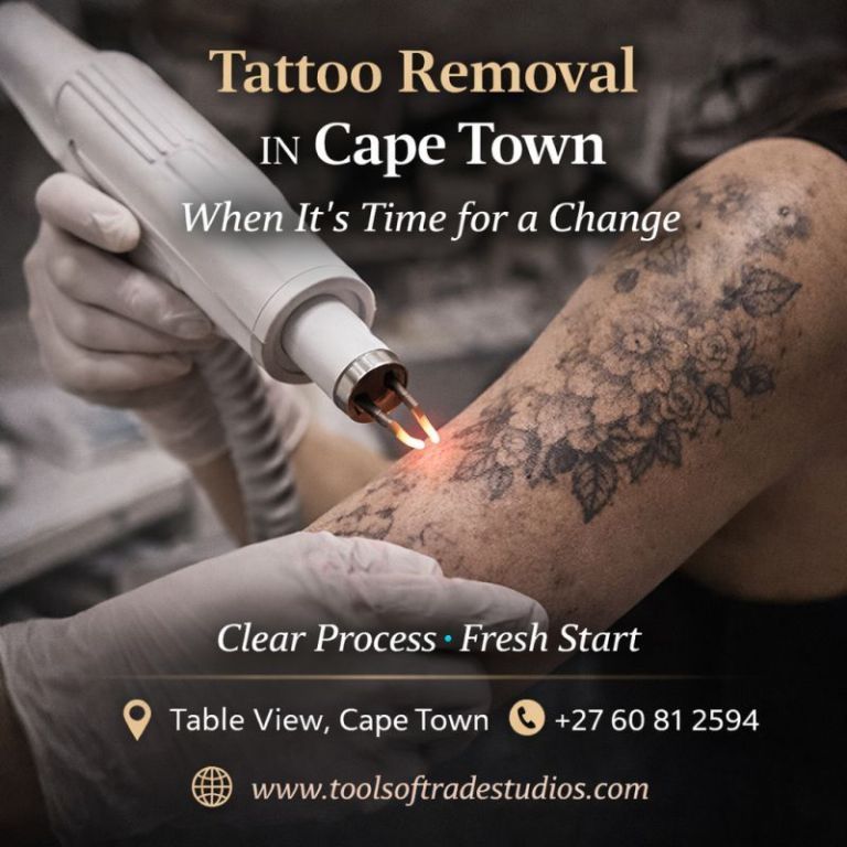 tattoo-removal-in-cape-town-when-its-time-for-a-change-big-0