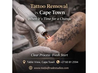 tattoo-removal-in-cape-town-when-its-time-for-a-change-small-0
