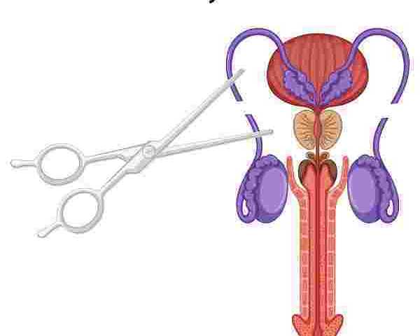 permanent-birth-control-options-for-cape-town-men